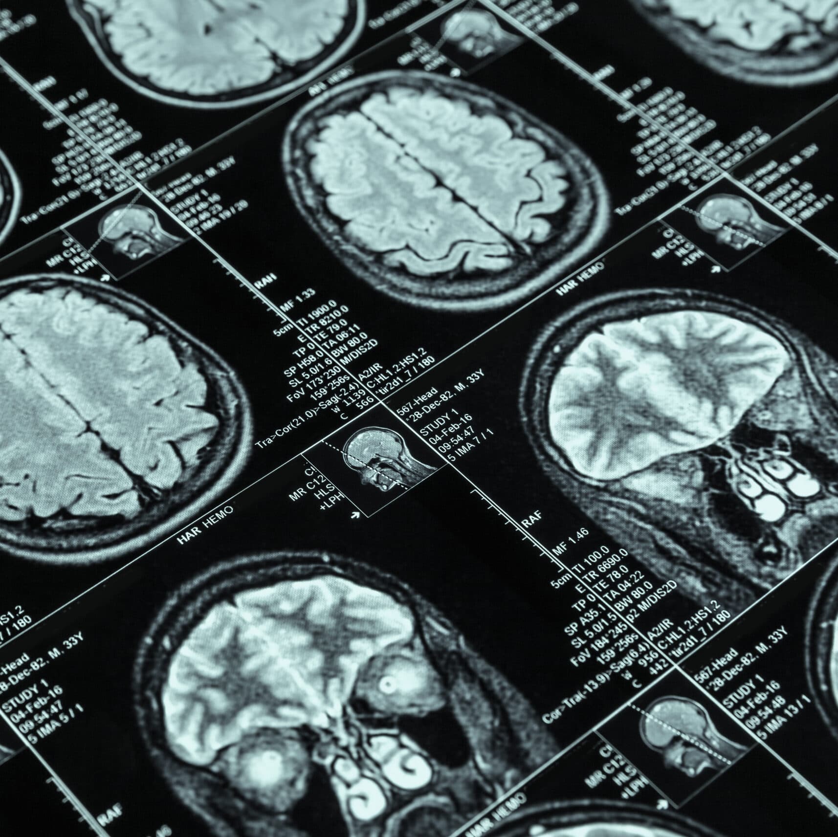 Some medical scans of a brain